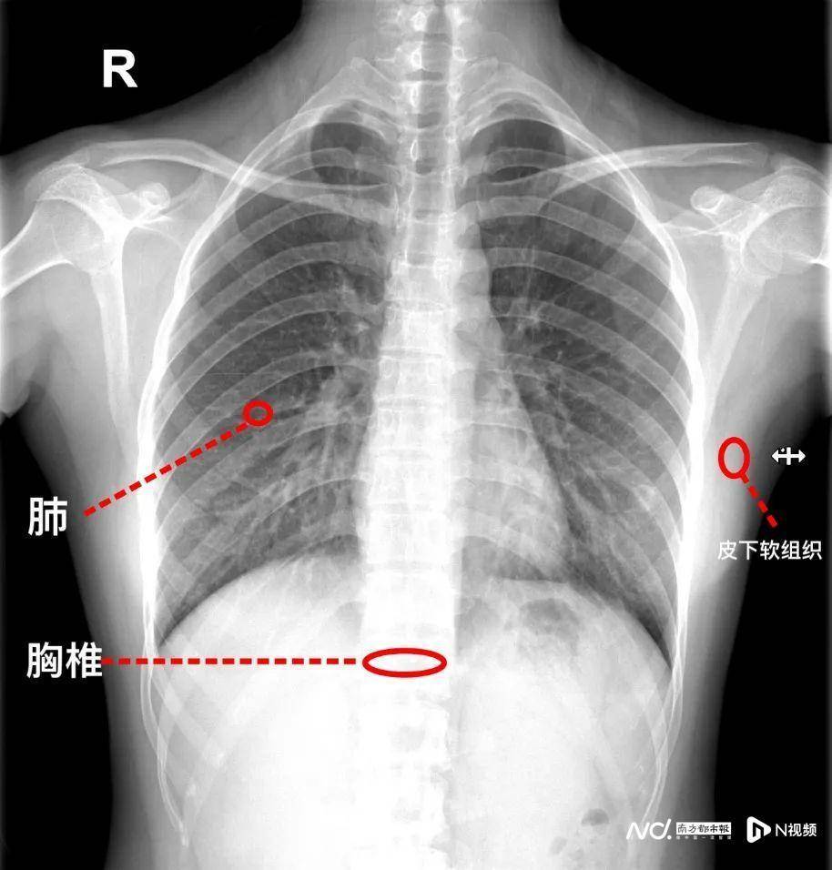 做了CT还要核磁共振？拍片做何筹办？专家提醒了