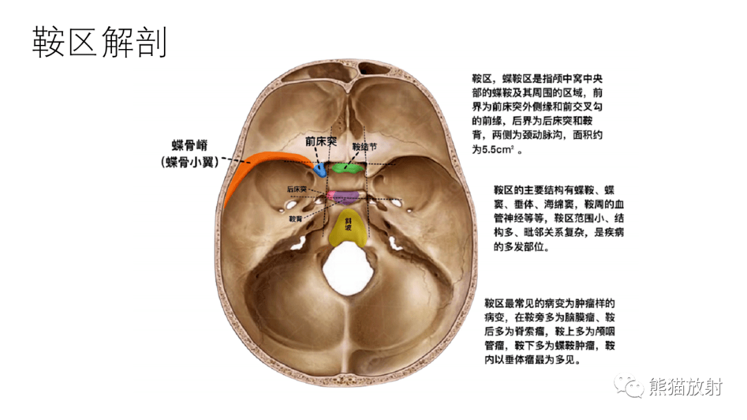 脑部鞍区图片