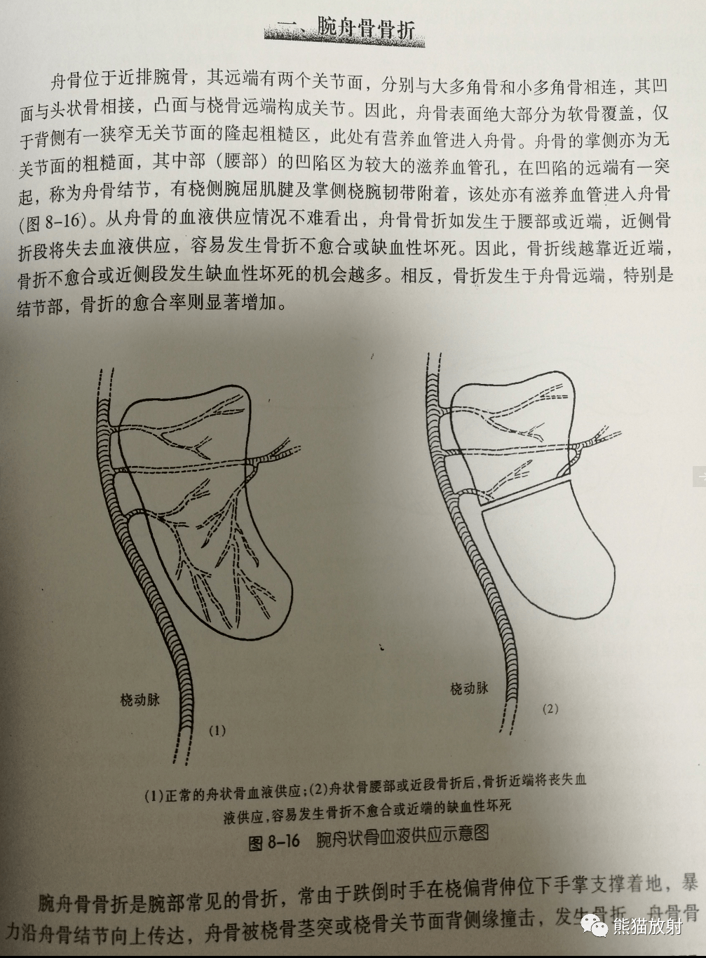 case丨腕舟骨骨折~_右腕_自行車_微信