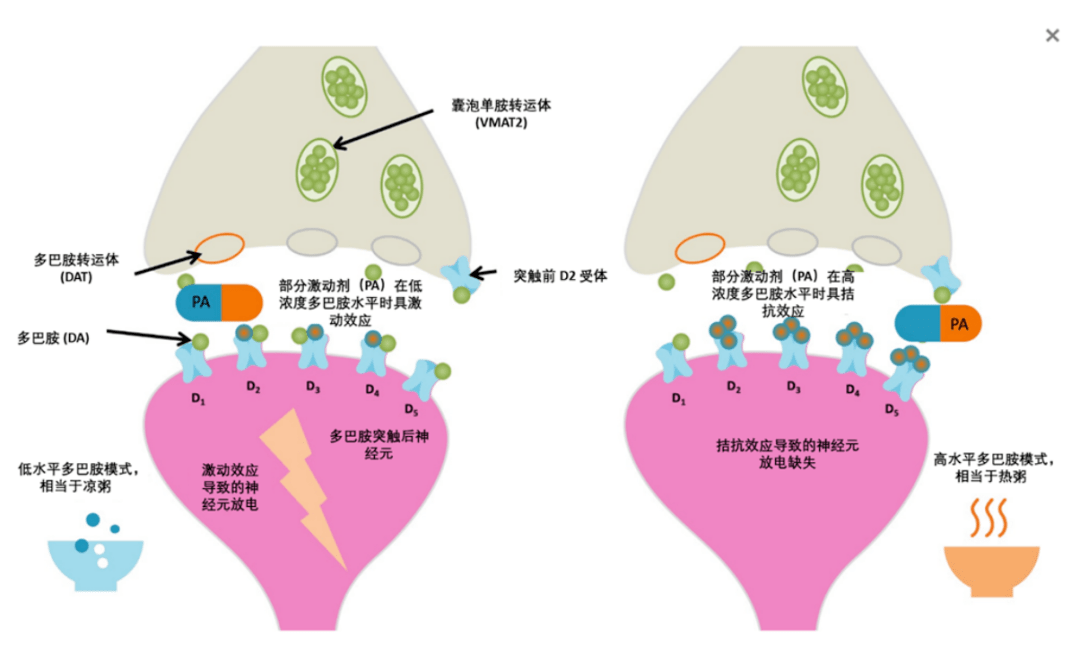 阿尔茨海默病痴呆相关激越症状(aad)药物brexpiprazole