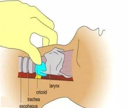麻醉诱导及维持