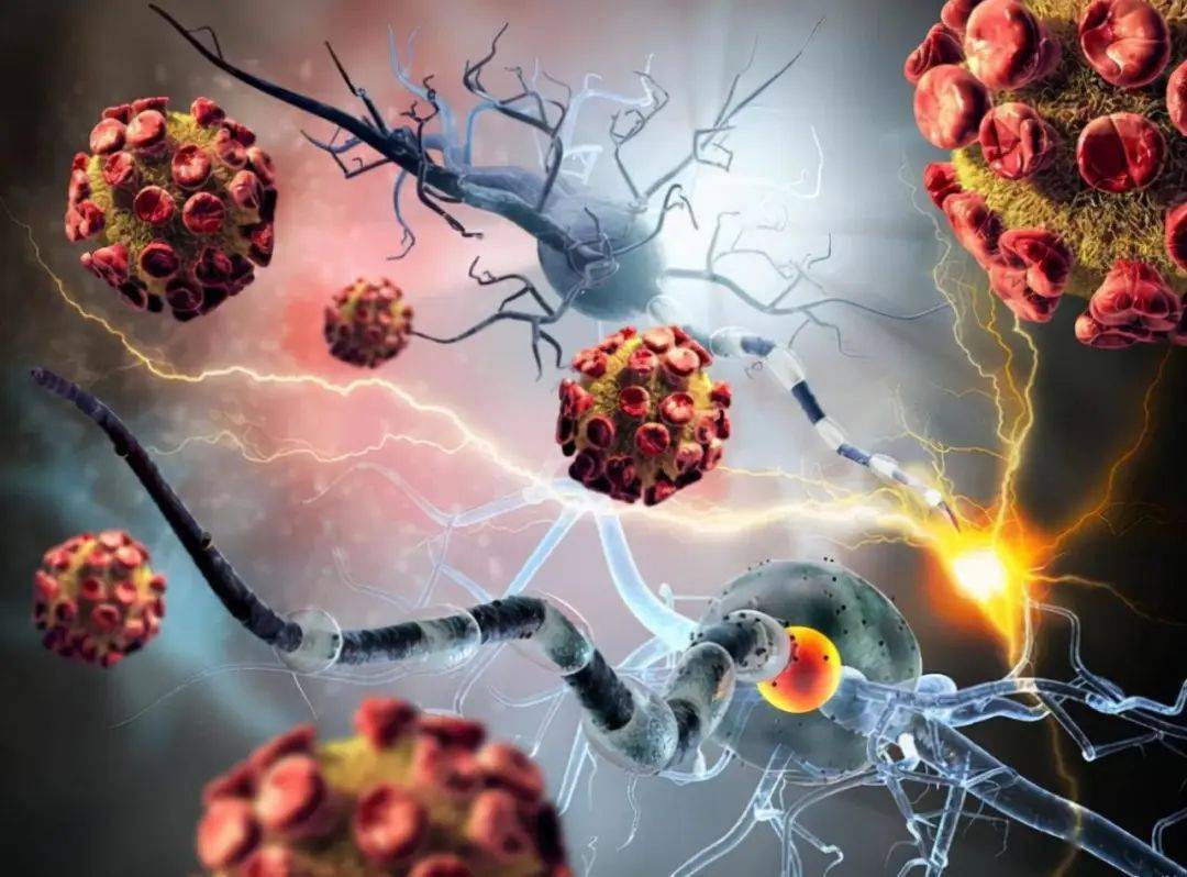 提醒:癌细胞扩散时,身体常有这4种异样_淋巴_组织_部位