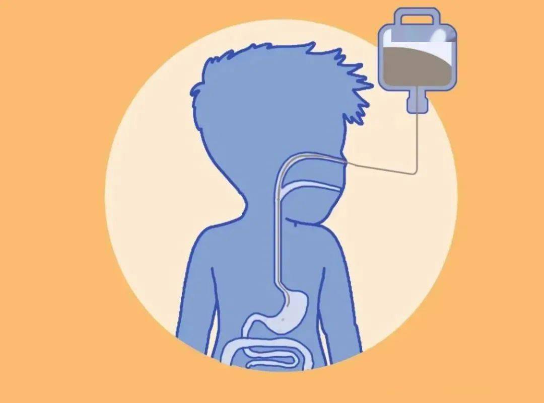 【健康科普】关于肠内营养您应该知道的科普知识