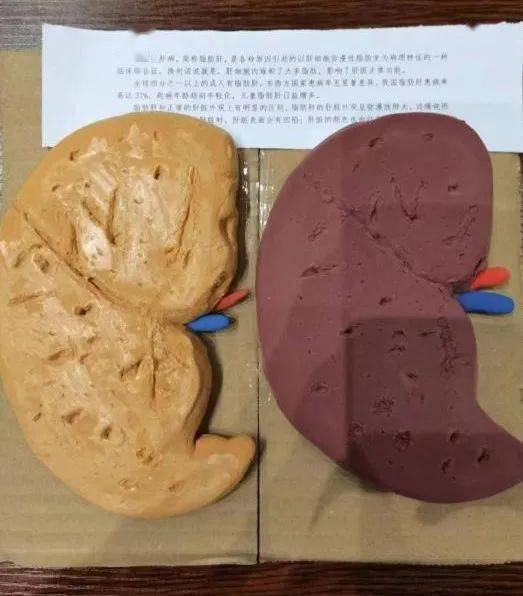 医学模型制作大赛作品图片