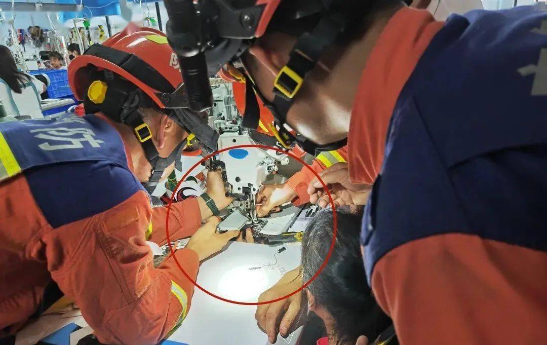 缝纫机扎穿女工食指._手指_进行_员工