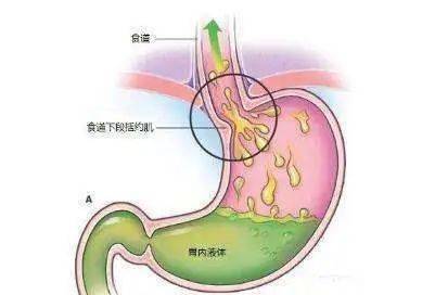 还没缓过来,胃里又在翻江倒海,想吐又吐不出来,只有酸水从胃里不断往