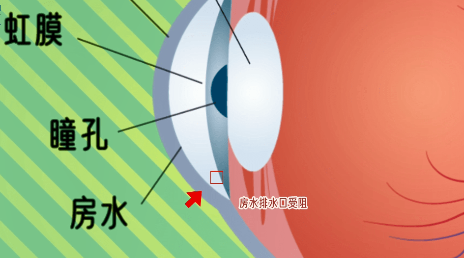 眼睛房水位置图片图片