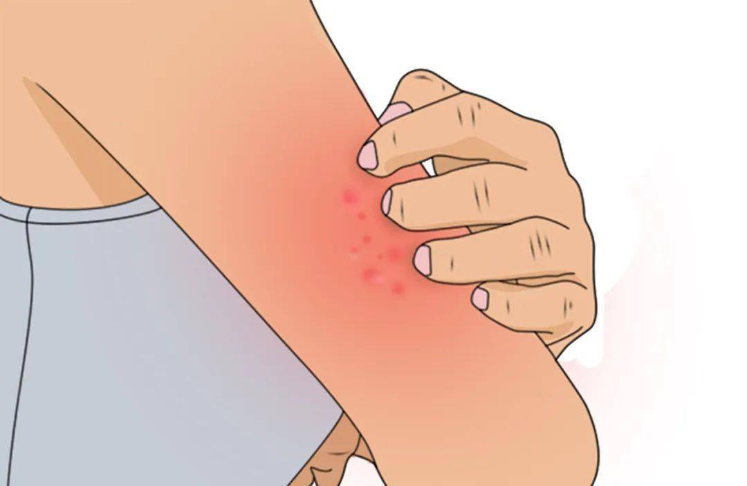 划痕_治疗_症状