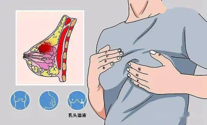  乳头　自我　中国 