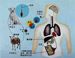 肝巨大囊肿小心包虫病