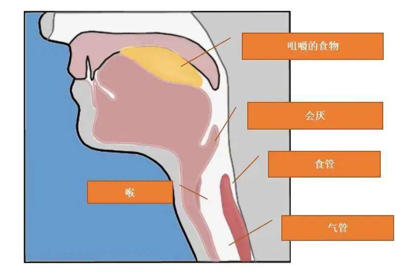 是谁对她"一招锁喉"?_会厌_患者_小伙