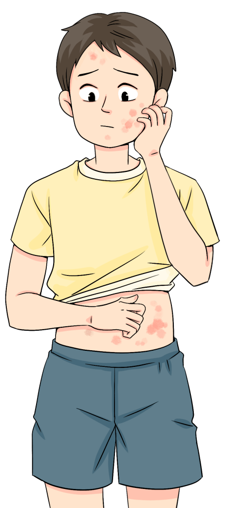 考前遭遇这种"巨痒"皮肤病,怎么办?