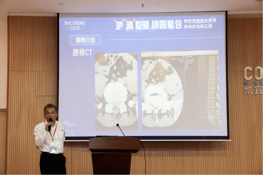 本次学术沙龙安排了手术直播,由昆明医科大学第一附属医院宋恩教授