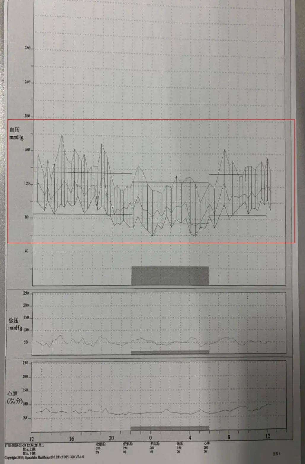 孕妇24小时动态血压图片