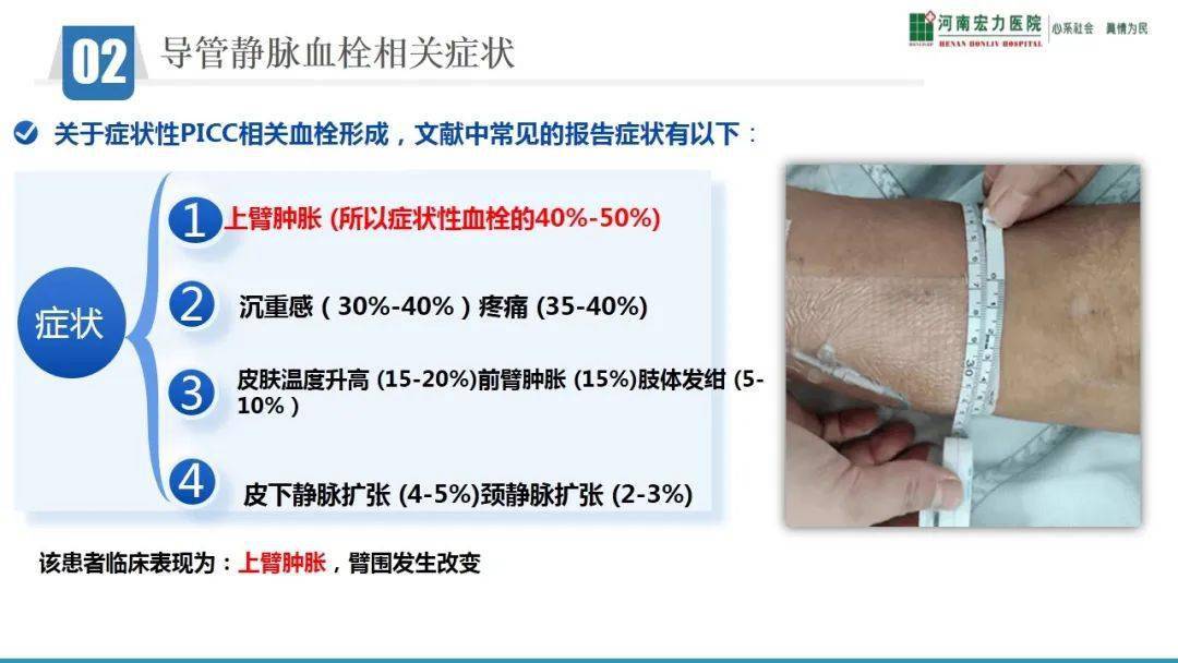 【ppt】一例picc导管血栓形成的个案分析_护理_微信_直播