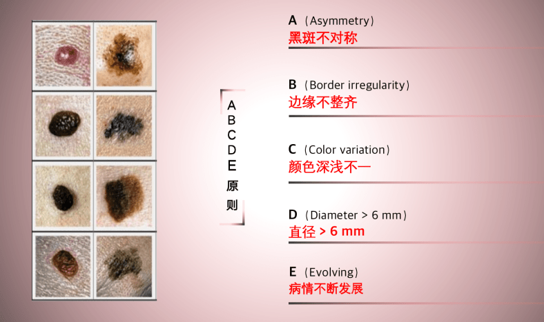 舌头上有黑斑图片图片