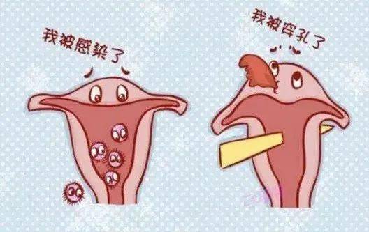 人工流产后,菇凉小腹总是疼痛,没料到差点…