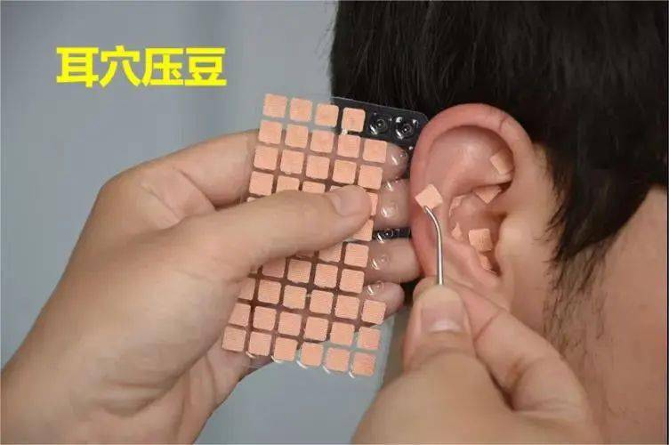 耳朵压豆法是辅助治疗办法,如果有相应不适症状的,必须就医明确检查