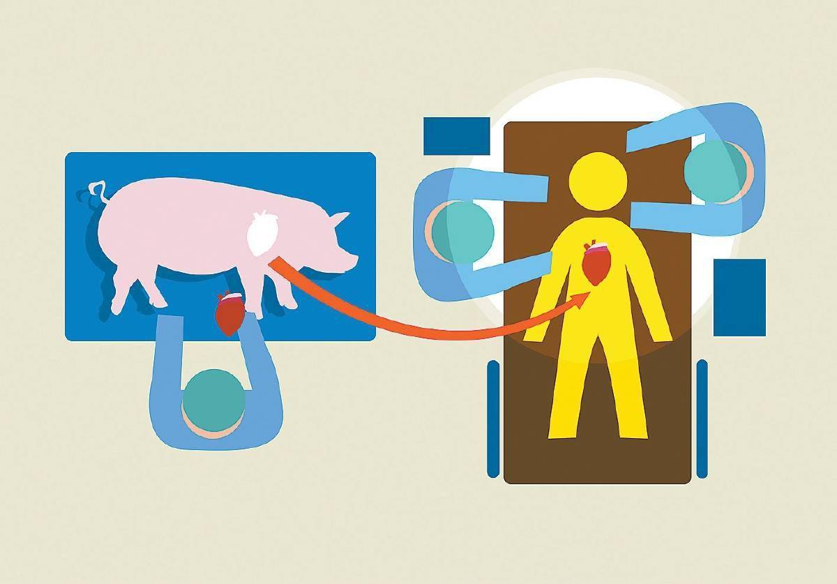 异种器官移植还有希望吗_心脏_患者_大卫·贝内特