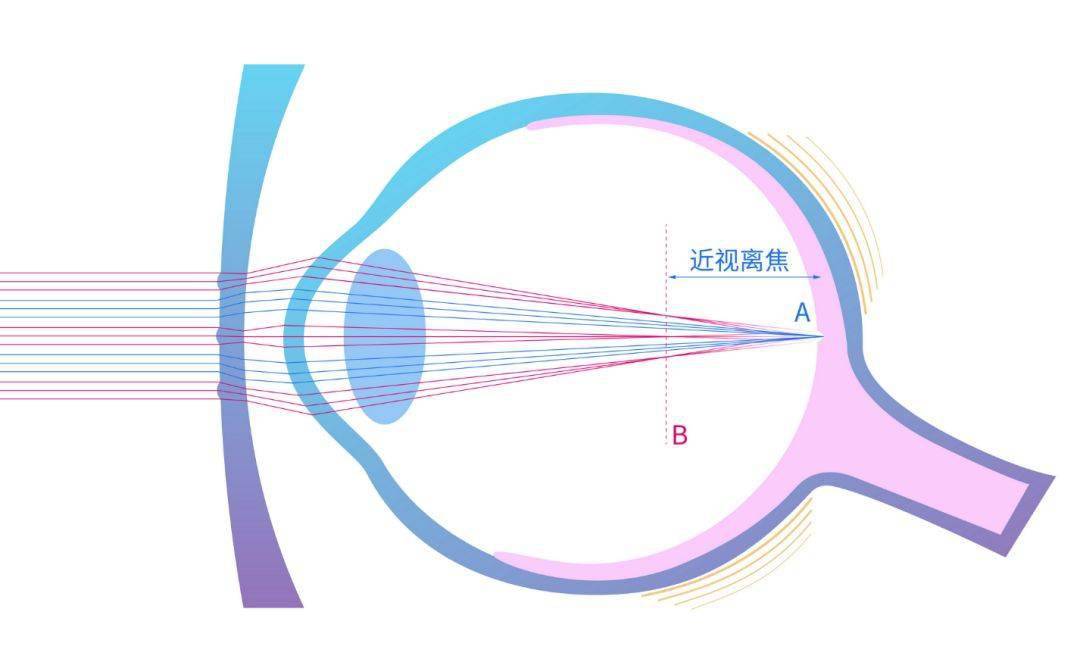 新乐学镜片价格表图片