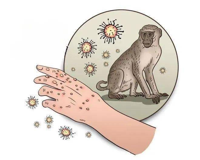 广东7月新增报告115例猴痘病例,有这4个特点_传播_人群_动物