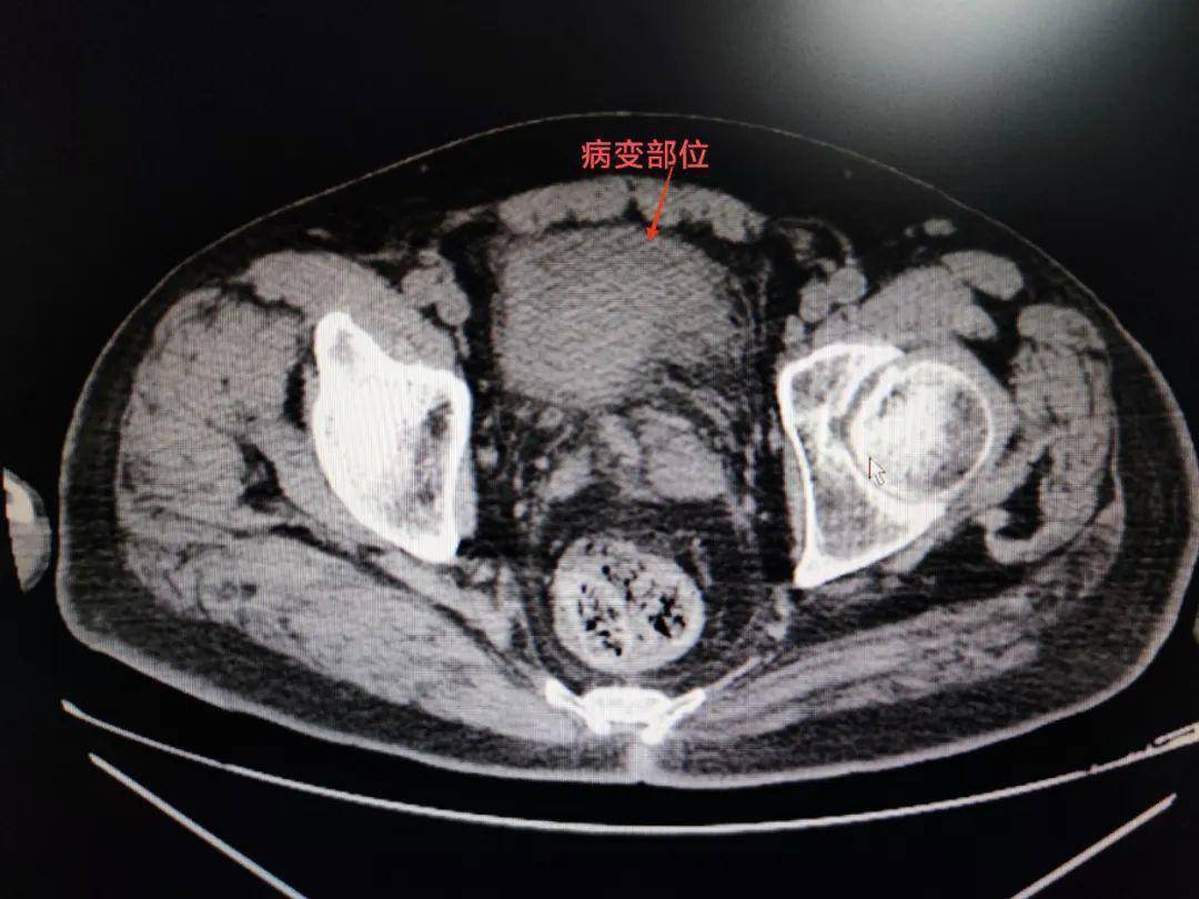 竟然是……_患者_医生_膀胱