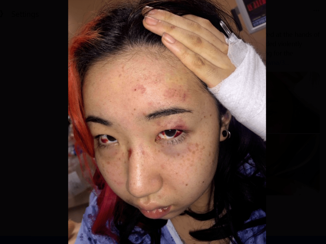 华裔ubc女生被女警暴力执法踩头 法官竟然这样判!_布朗宁_莫娜_袭击