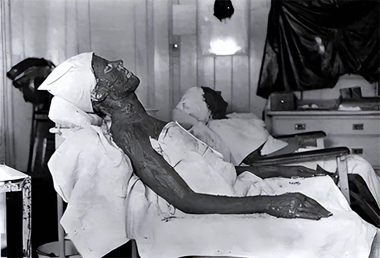 男子4年喝1400瓶核辐射水,身体从里到外溶解,30年后遗骨还发热