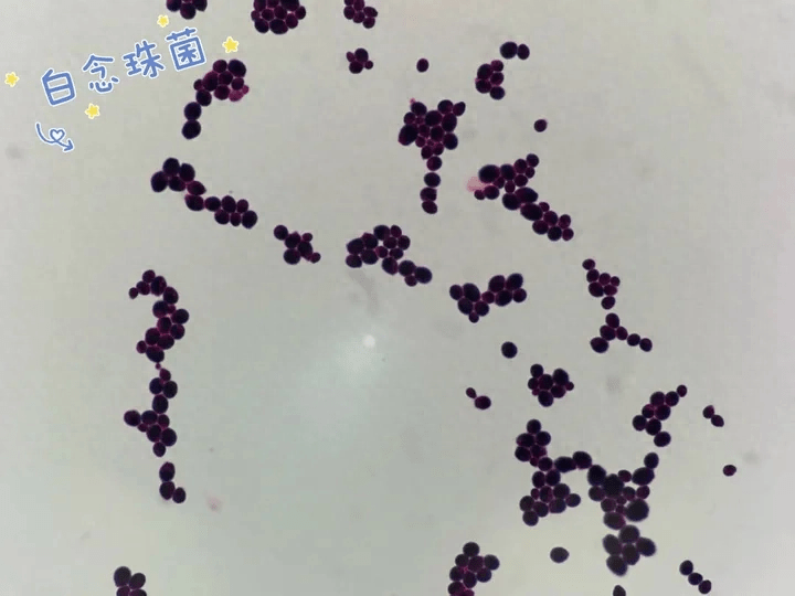 【革兰染色显微镜下形态】其中翡翠样的绿色(白念珠菌)是罪魁祸首