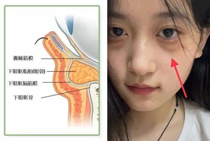 马应龙_效果_肌肤