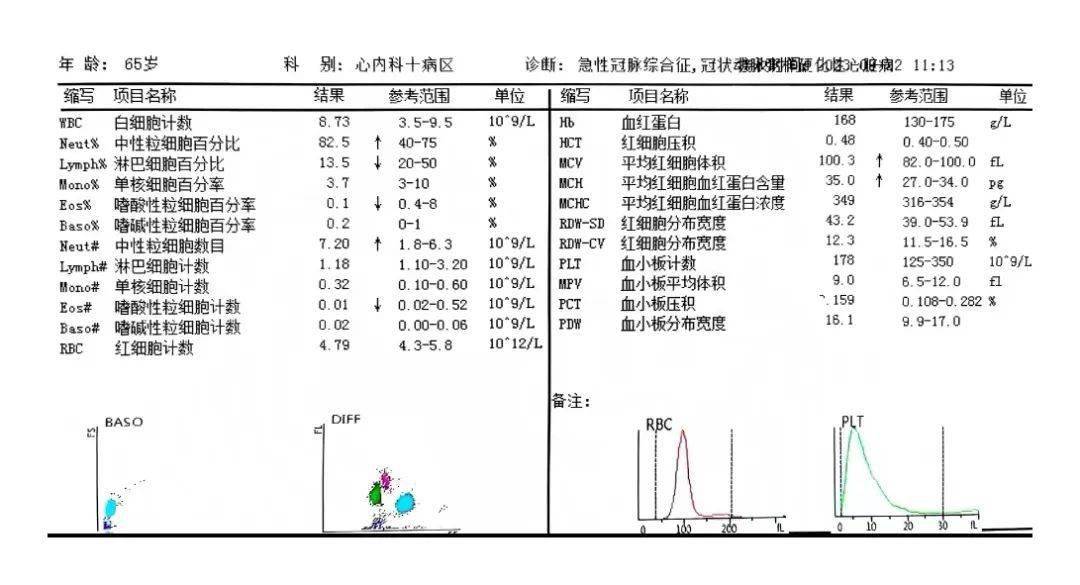 由重度溶血引起血小板假性增高启发的思考