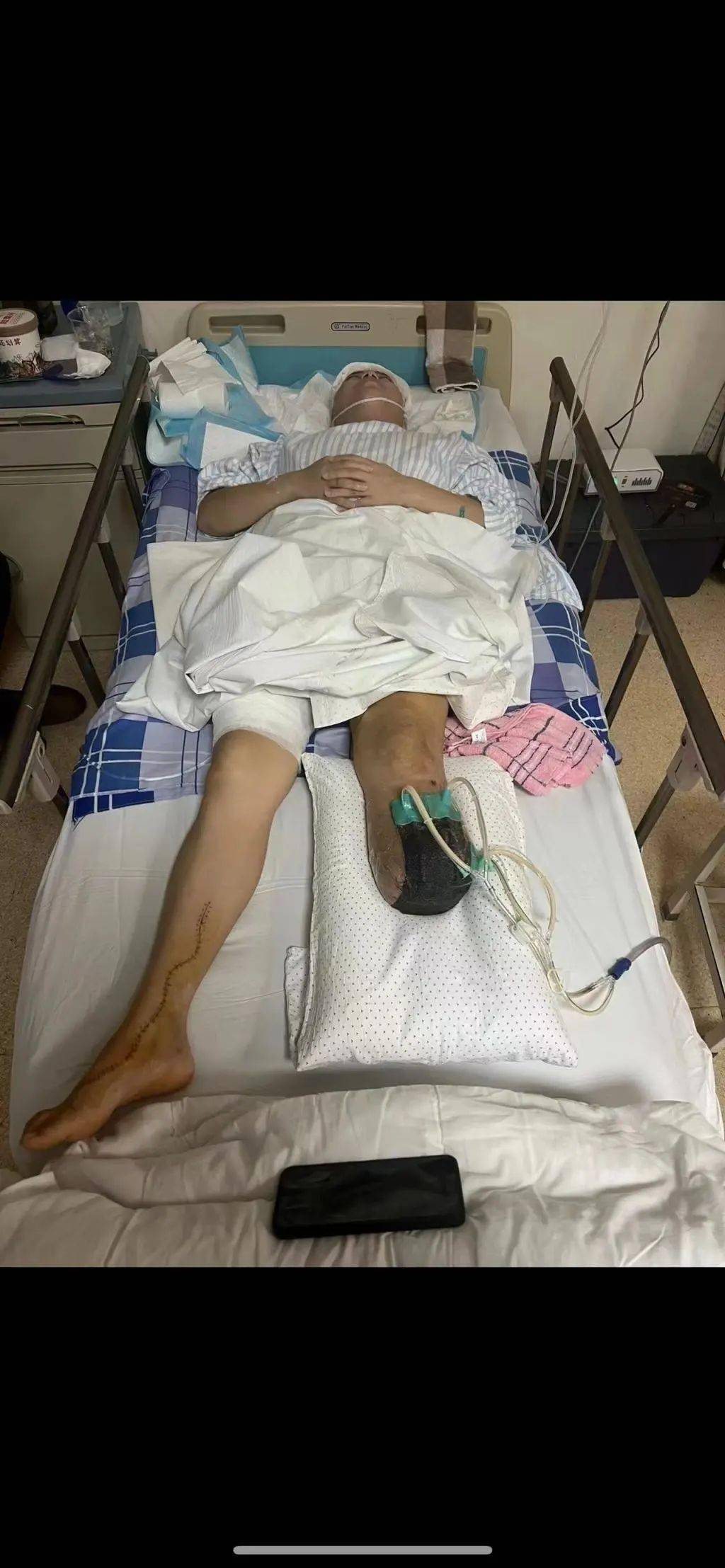 为救同事,21岁女大学生遭遇截肢!