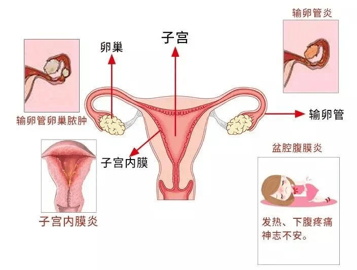 子宫卵巢输卵管示意图图片