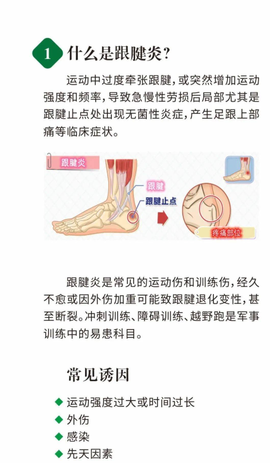 跟腱炎的症状图片