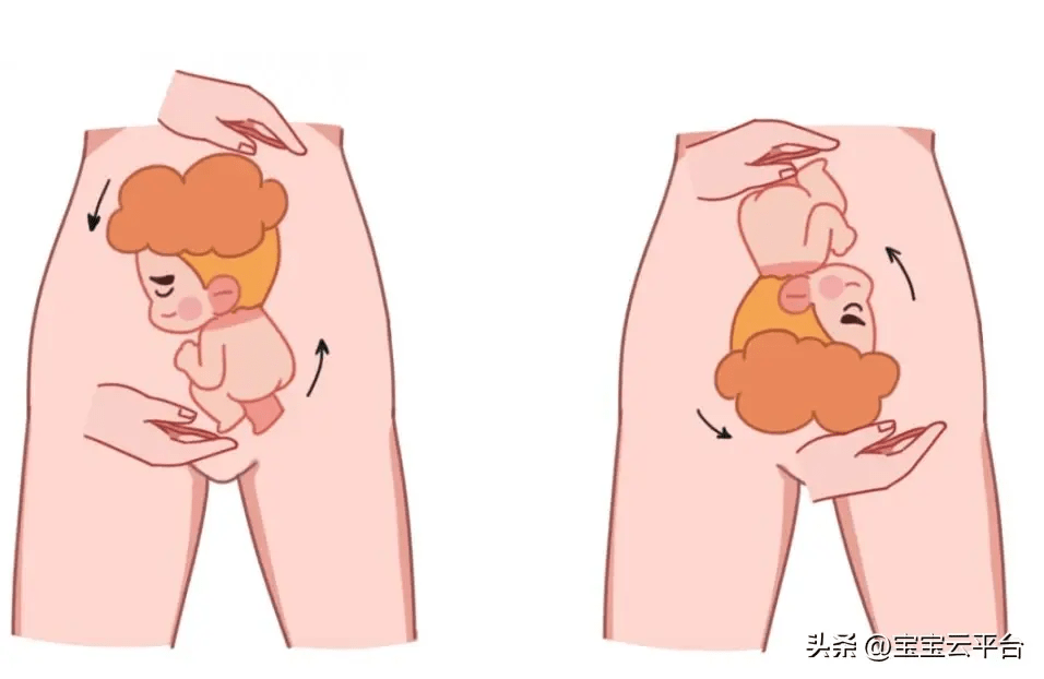 关于胎儿臀位,孕妈妈要提前了解这些知识点_宝宝_脐带_胎位