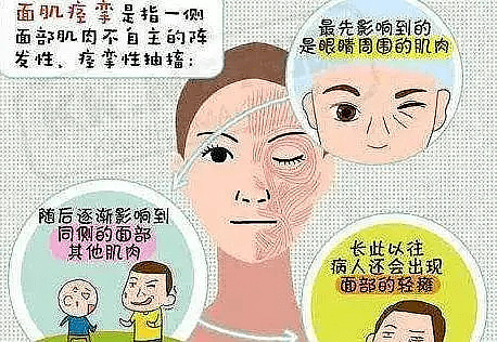 【健康科普】带您了解一下面肌痉挛_治疗_患者_血管