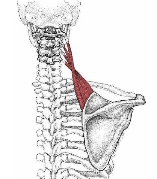 肩胛提肌肿大图片