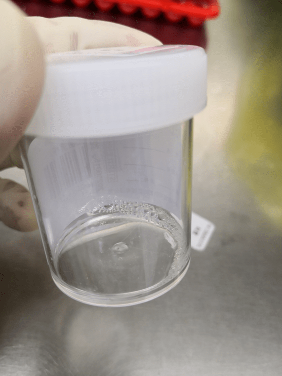 "痰"吐优雅,送去检验科的痰液究竟会经历什么呢?