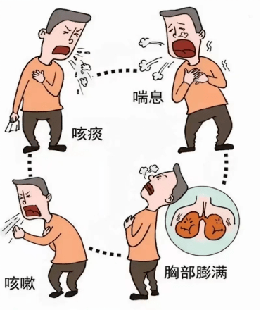慢阻肺三大症状 来自搜狐网
