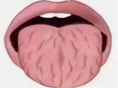 【健康科普】口腔科——异常的舌头