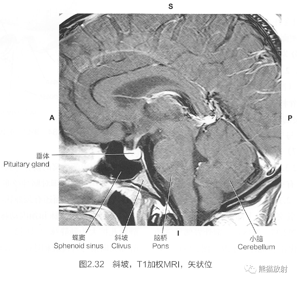 斷解選讀丨腦顱之蝶骨,枕骨_全網_影像_解剖圖