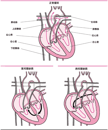 心房心室图四格图片