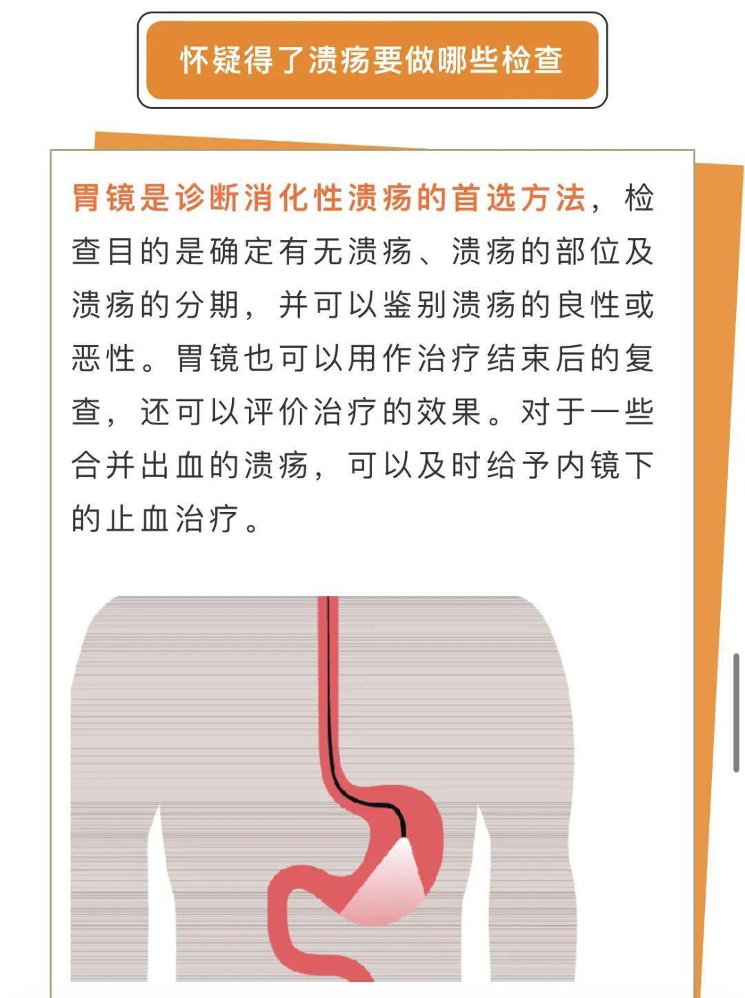 十二指肠溃疡原因图片