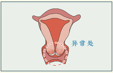 問題_影響_名字