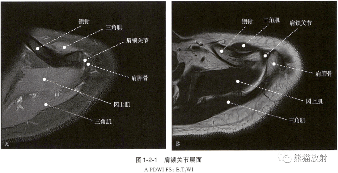 肩关节三维解剖图图片