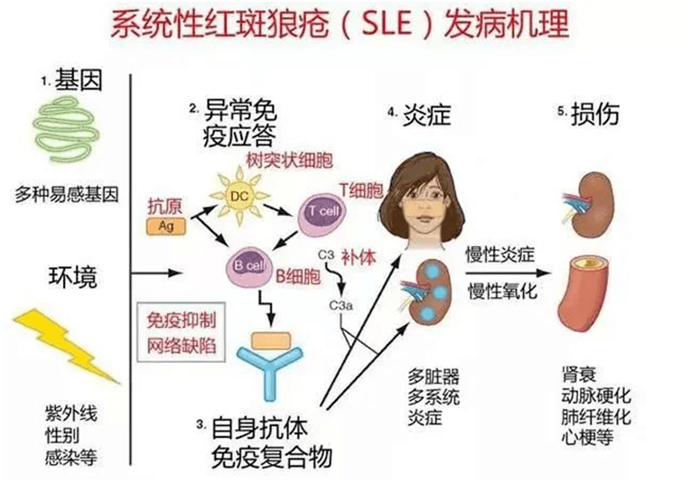 【翔图·科普】带您了解系统性红斑狼疮!_治疗_疾病_患者