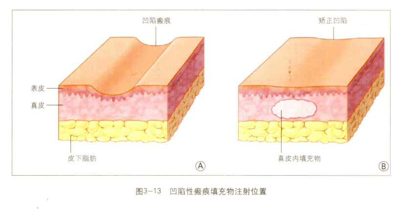 治療_方式_兒童