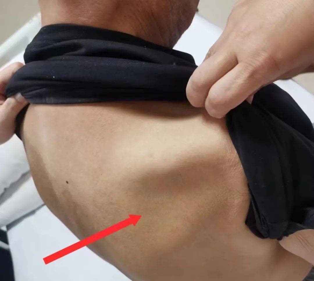 并告诉他们,适度锻炼可以帮助延缓肌肉萎缩,关节僵硬,尽可能保持肌肉