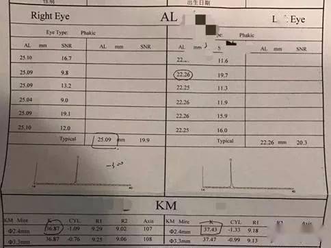 解密|1000度高度遠視是否一定會形成弱視?_患者_調節_檢查